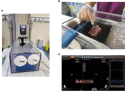 Effect of Baseline Impedance in Radiofrequency Delivery on Lesion Characteristics and the Relationship Between Impedance and Steam Pops